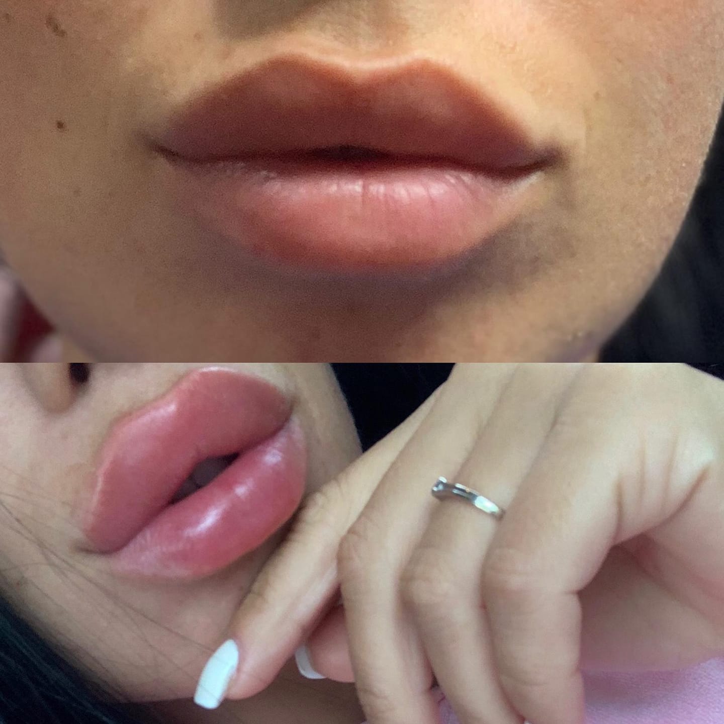 Cum a reușit "Dr. Lana" să mutileze zeci de femei în București. Toate au rămas desfigurate și au dureri insuportabile