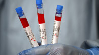 doctor ține în mână trei teste coronavirus