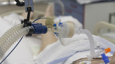 terapie intensiva pacient intubat