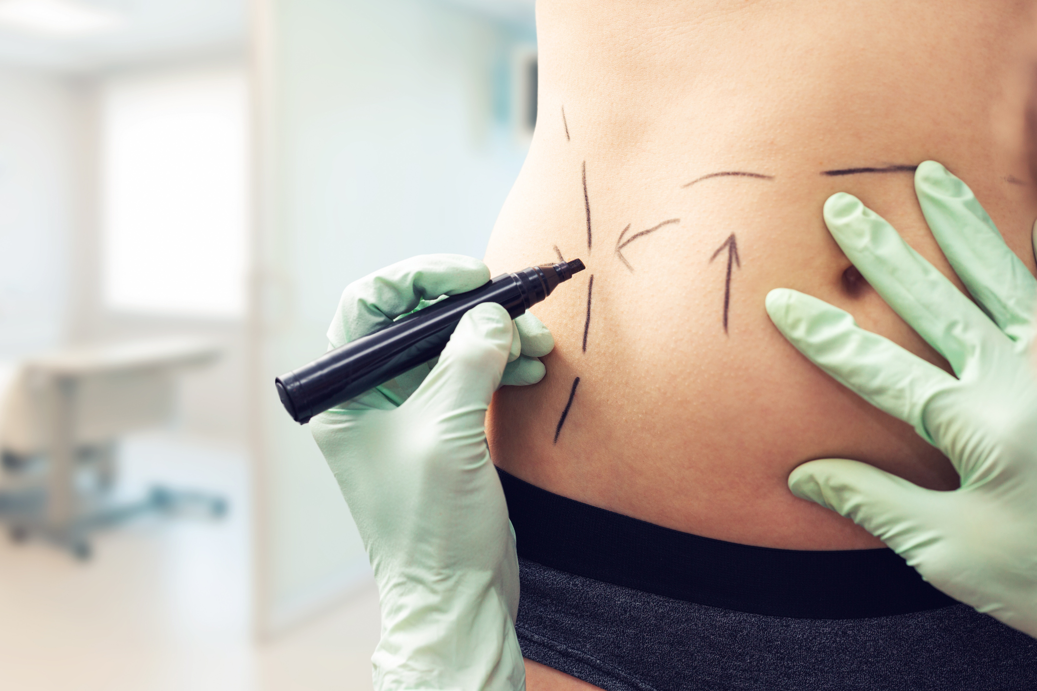 Hackerii au spart rețeaua IT a unei mari rețele de chirurgie estetică și amenință să publice fotografiile pacienților
