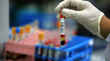 Israeli Laboratory Leads Western World In Blood Testing