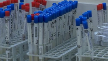 flacoane sange test hiv