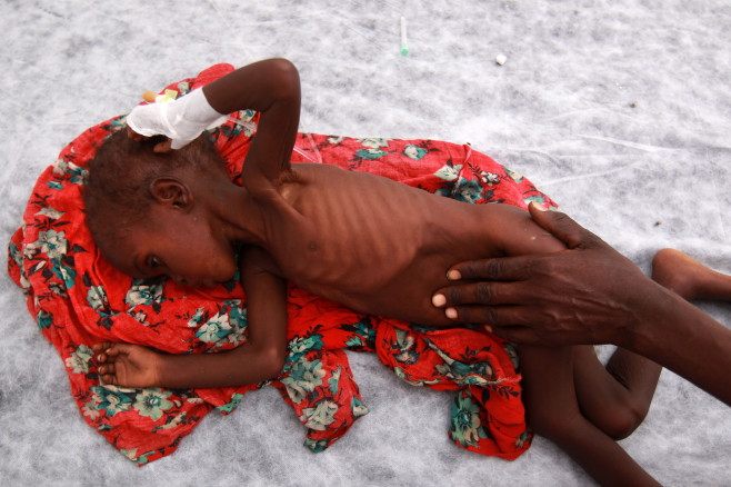 Somali Famine Refugees Seek Aid In Mogadishu