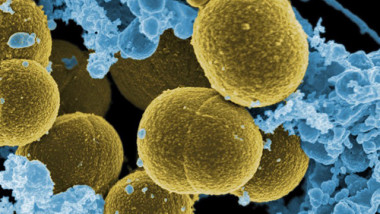 Staphylococcus aureauMagnification 20,000
