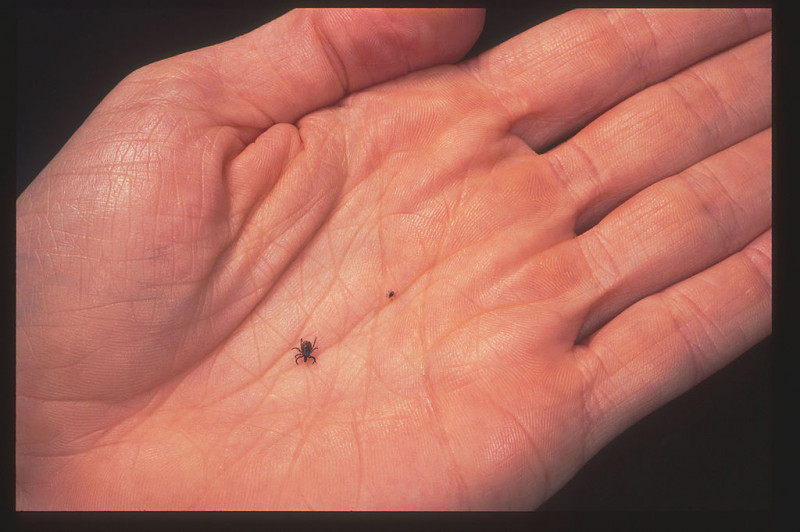 Close Up Of An Adult Female And Nymph Tick Is Shown June 15 2001 In The Palm Of A Mode