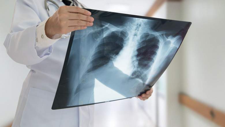 doctor cu radiografie shutterstock_560923156