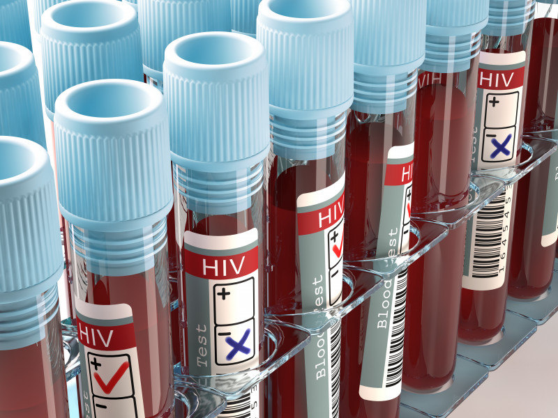 sange hiv sida analize