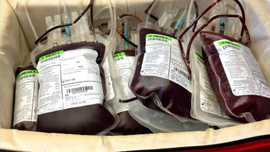 transfuzii