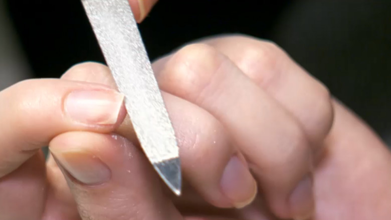 cum să vindeci ciuperca unghiilor de pe deget u tratament ciuperca unghiilor
