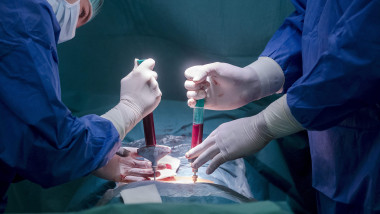 Children during stem cell transplant treatment in Budapest