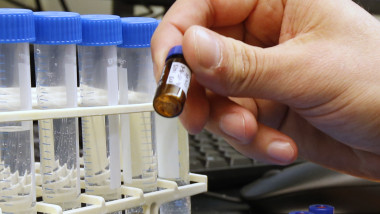 University of Utah Researchers Work Toward Cure For Ebola Strains