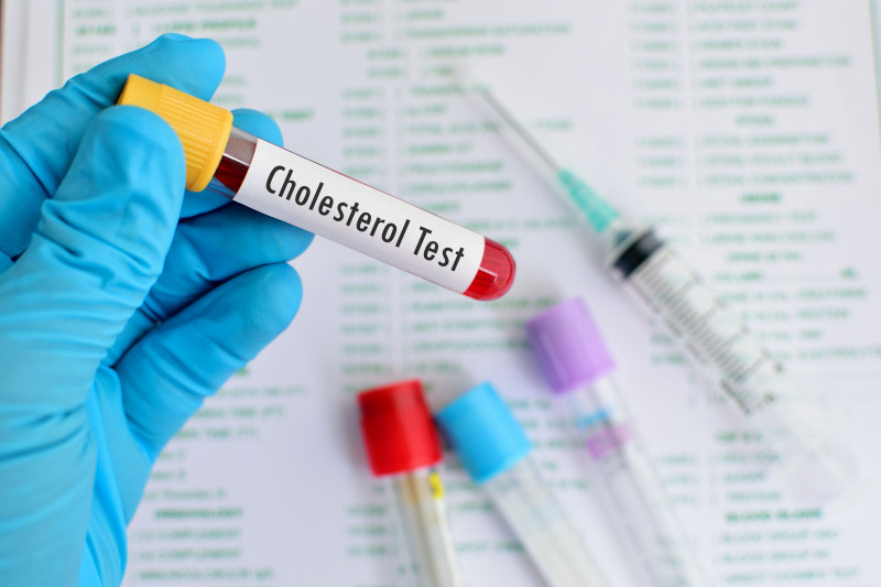 test colesterol shutterstock_341811503