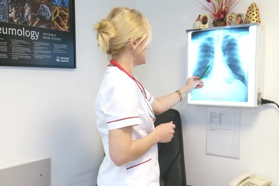 Cancerul de plamani ar putea fi identificat mai devreme datorita unei analize noi de sange