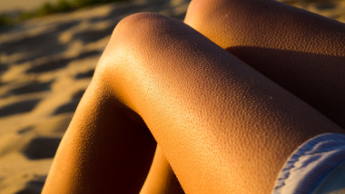 femeie cu piele de găină pe picioare