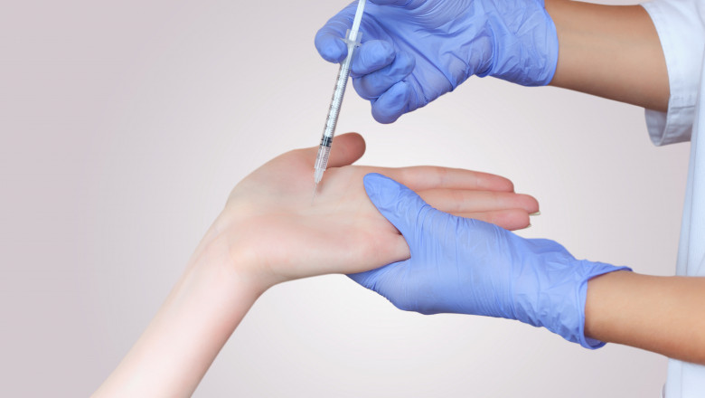 injectare botox infrumusetare clinica