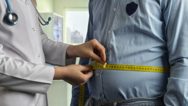 Measuring Overweight