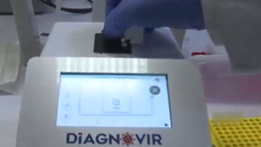 aparat de testat covid diagnovir