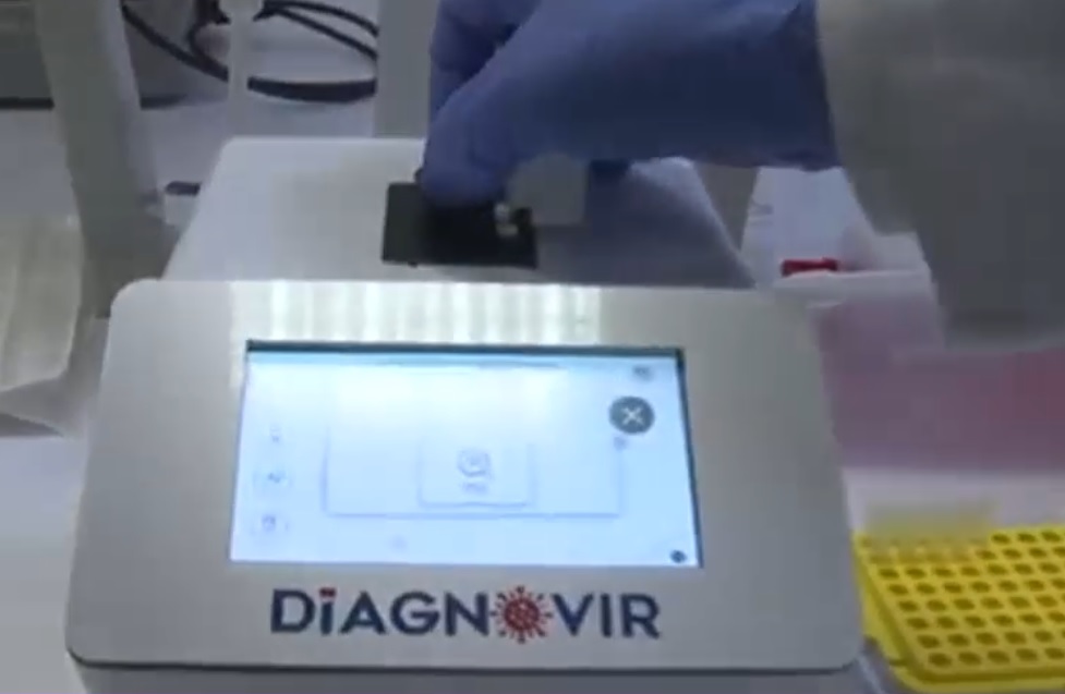 Un test care detectează Covid-19 în 10 secunde a fost inventat în Turcia