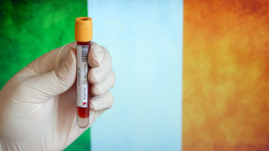 eprubeta sange test pozitiv la covid-19 pe steagul irlandei