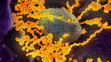 Imagine ilustrativ privind infectia cu coronavirus.