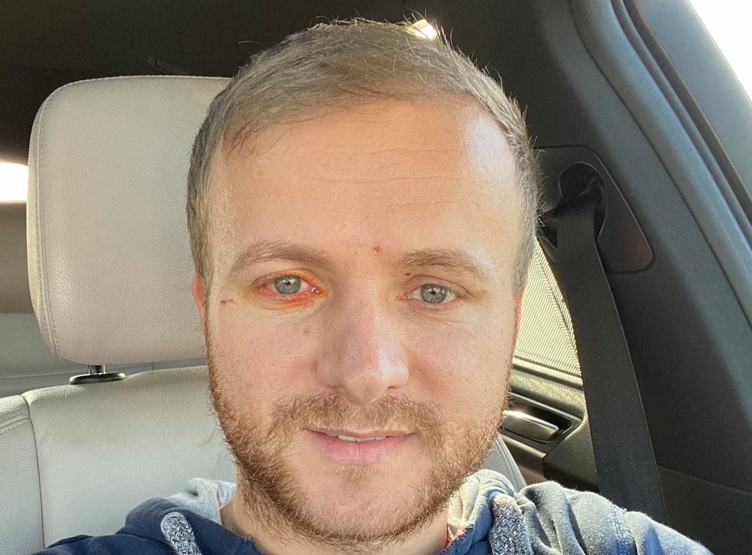 Cine este Daniel Bodnar, activistul de mediu aflat în stare gravă în urma unui accident rutier