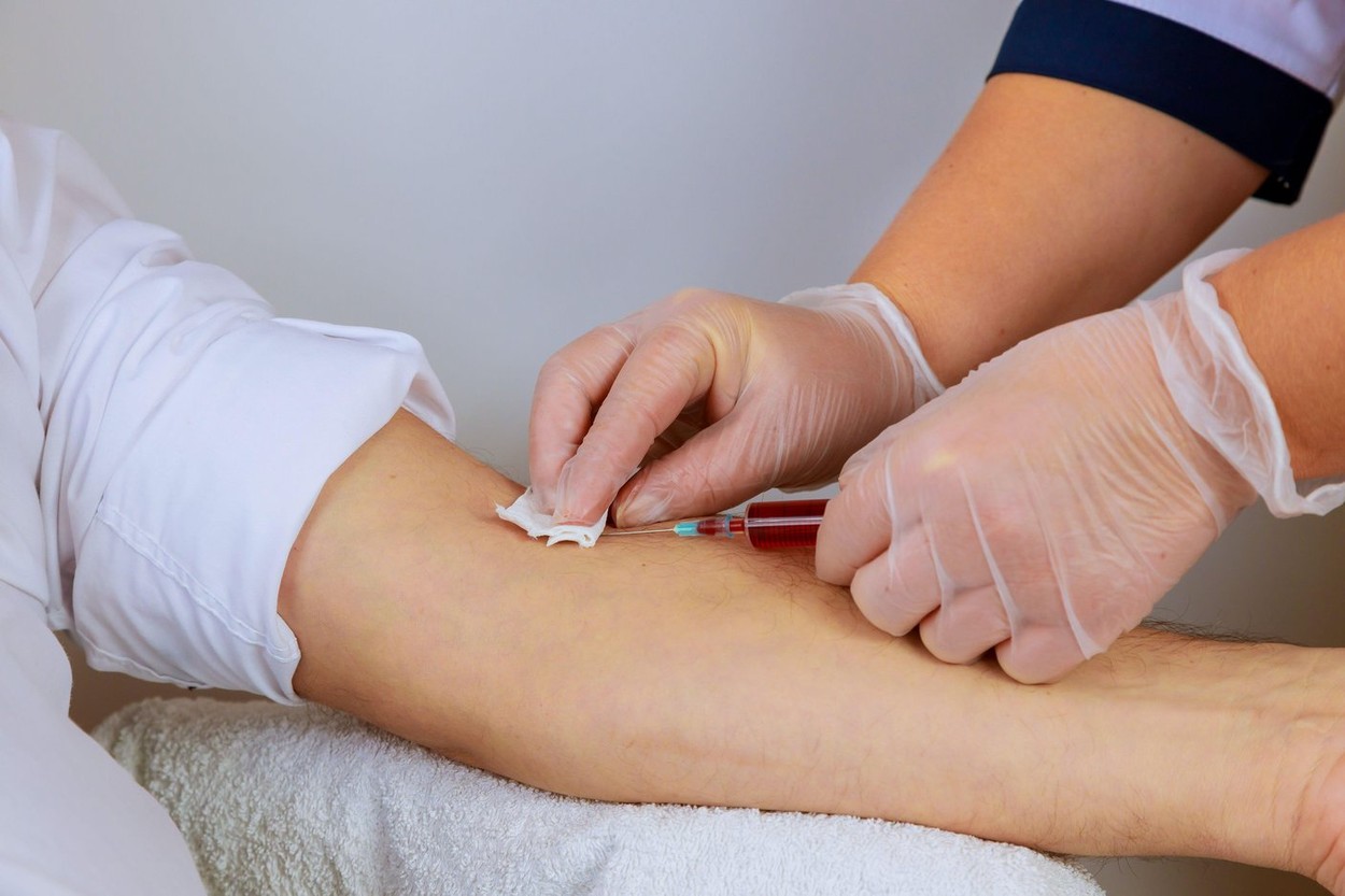 De ce nu merg romanii sa-si faca analize medicale