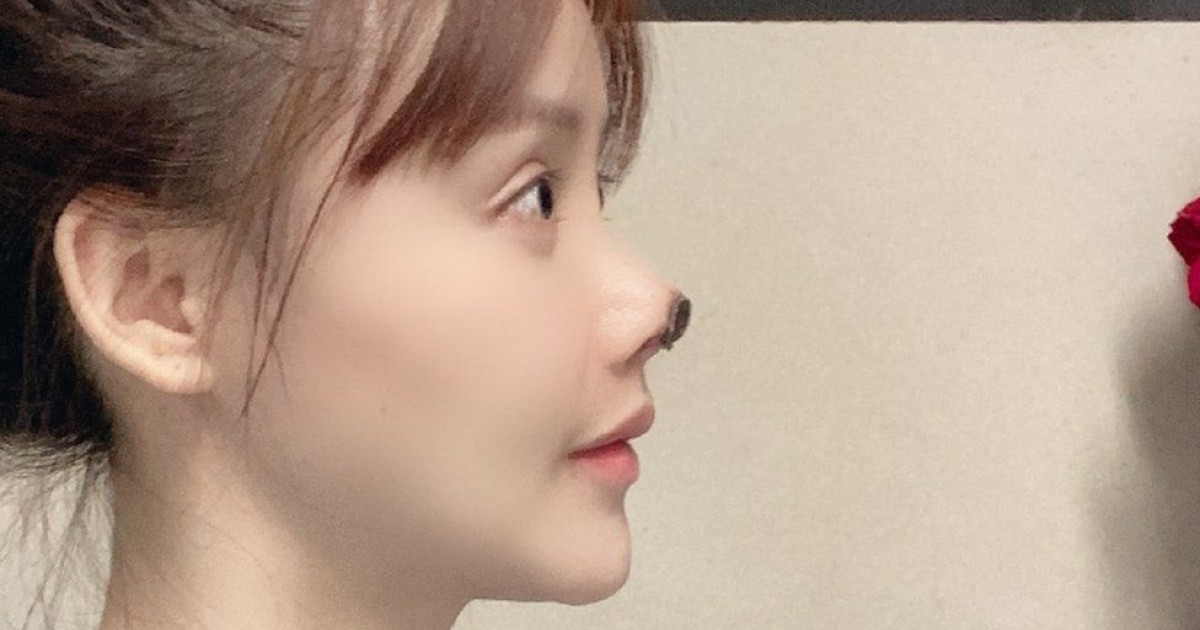 A popular actress in China has raised the alarm by posting shocking pictures with her nose after a failed cosmetic surgery