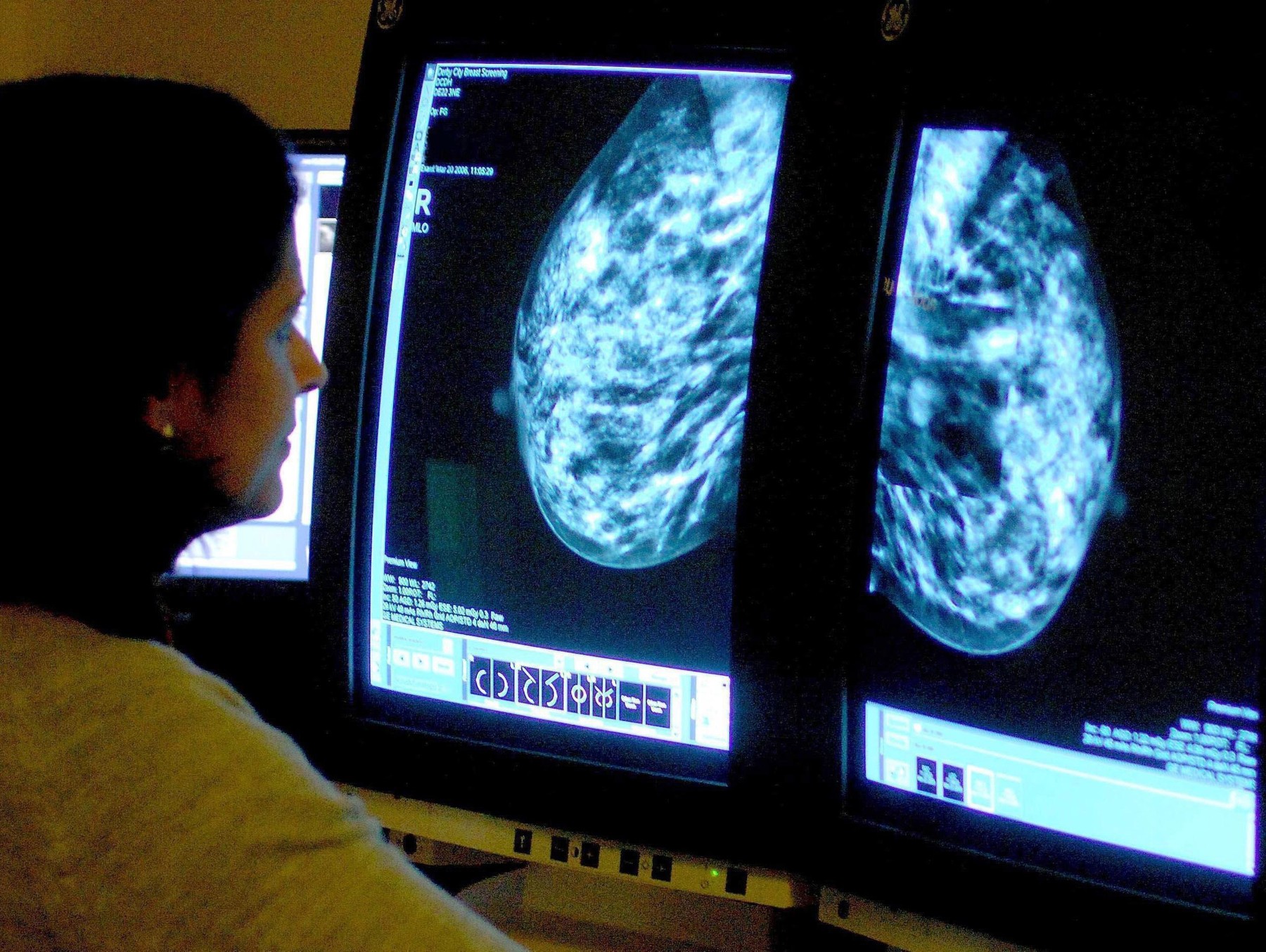 Planul UE de 4 miliarde de euro pentru combaterea cancerului. „Vrem să ne asigurăm că toţi bolnavii au aceleaşi şanse”