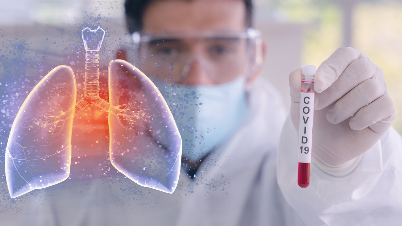 Ce categorii de pacienți au nevoie de evaluare computer tomograf după infecția COVID-19? Explicațiile specialiștilor
