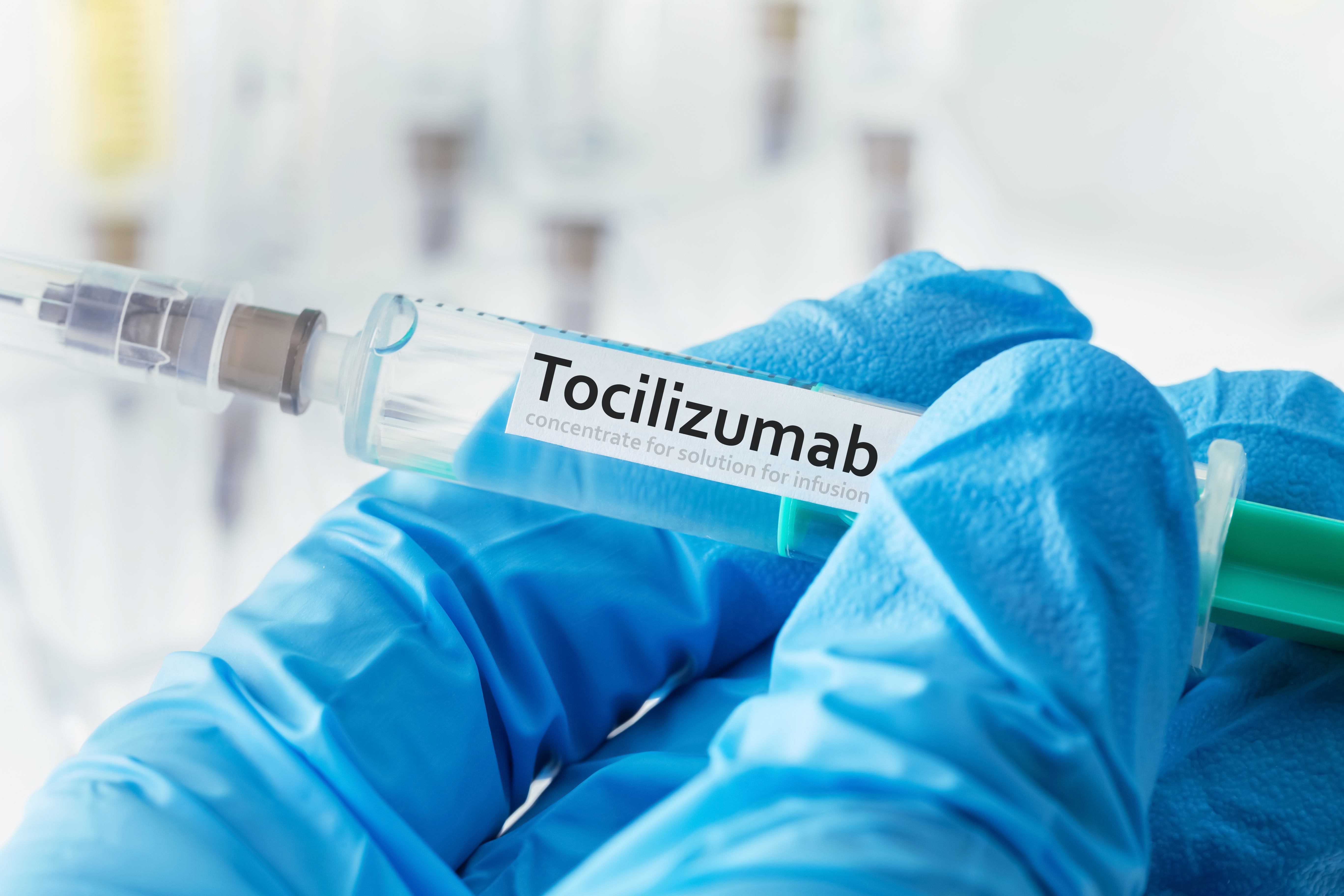 Tocilizumab, un medicament folosit pentru artrită, reduce riscul de deces la pacienții cu forme grave de COVID (studiu)