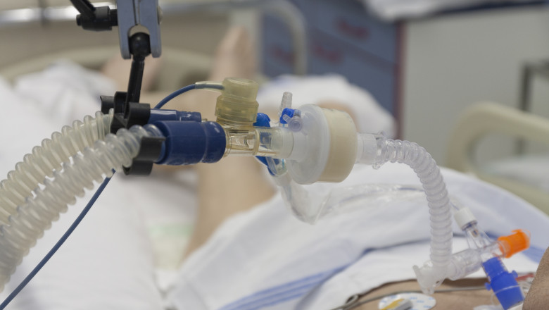 tub respirator conectat la un pacient