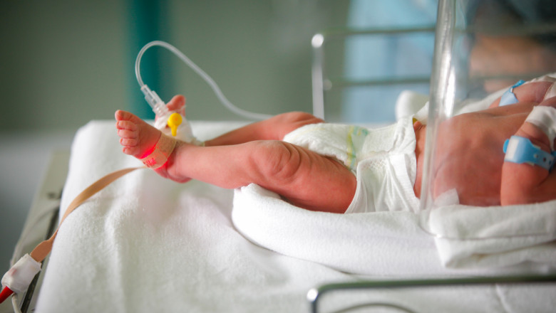 Un bebeluș născut prematur primește îngrijiri într-un incubator.