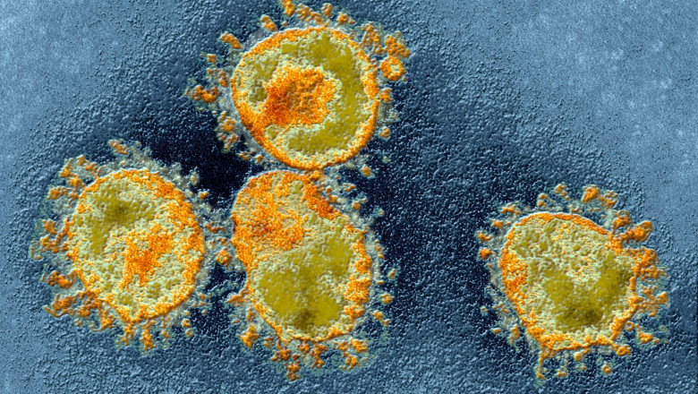 celula atacată de coronavirus