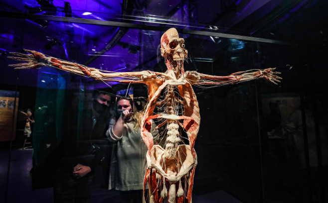 The exhibition Body Worlds in Moscow