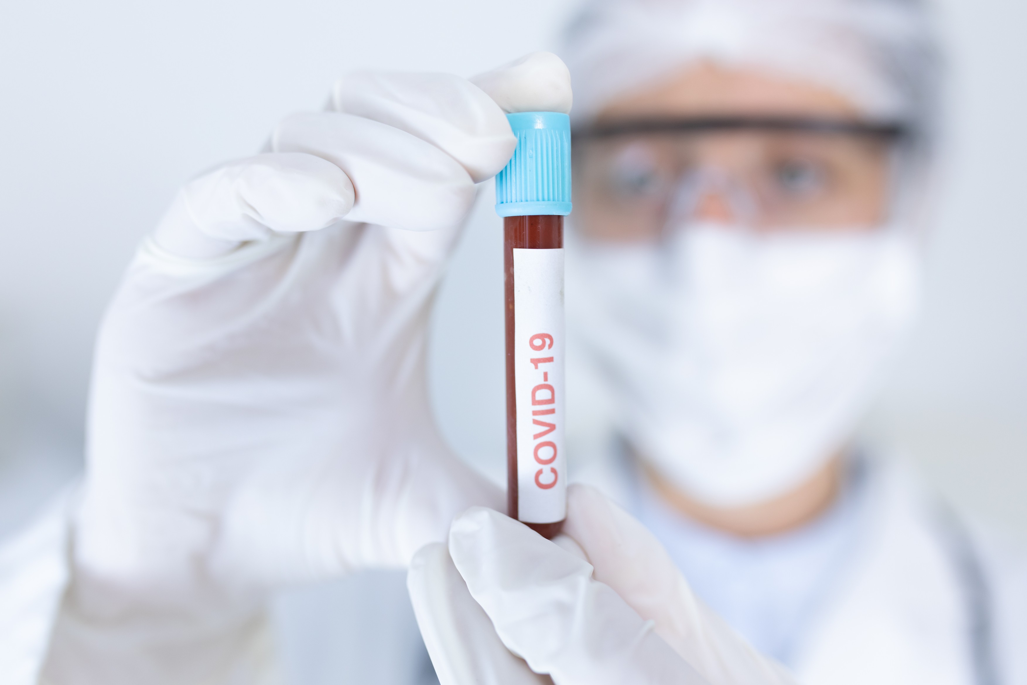153 de cazuri noi de coronavirus în ultimele 24 de ore, la mai puțin de 10.000 de teste efectuate