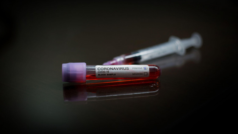 test covid coronavirus