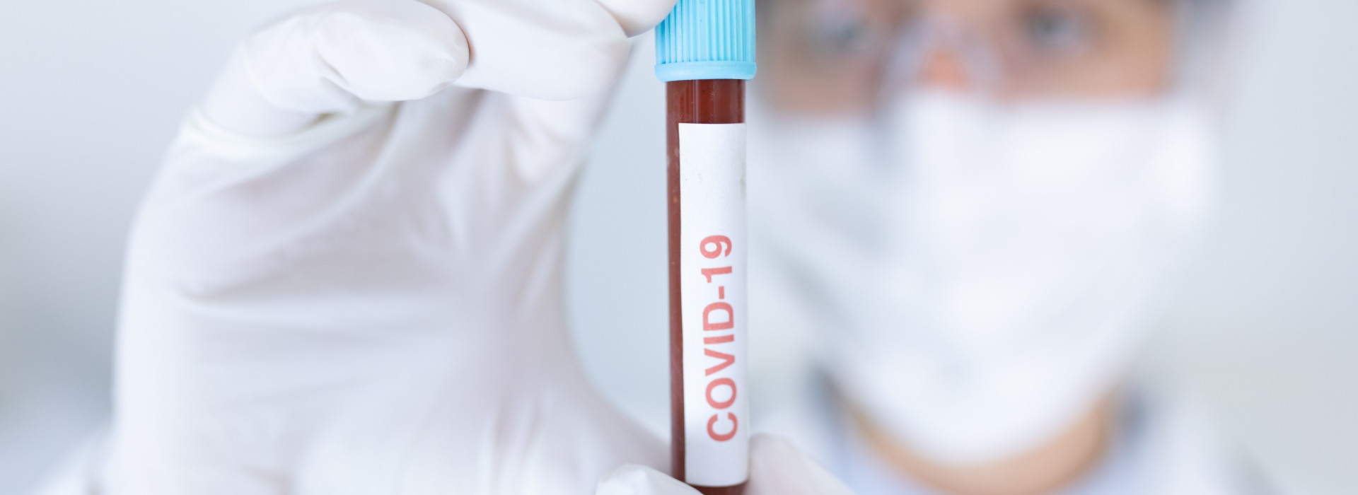 test covid-19 coronavirus