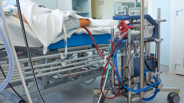 pacient conectat la aparatura pentru ECMO