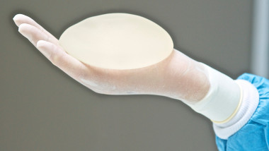 un cadru medical cu echipament de protectie tine in mana un implant mamar din silicom