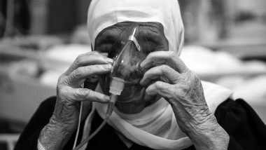 fotografie alb negru cu o femeie batrana care respiră cu ajutorul unui tub de oxigen