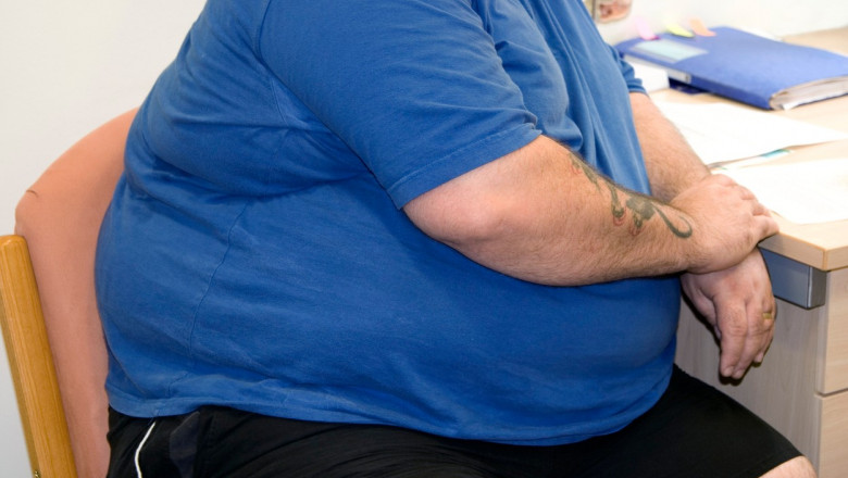 un barbat obez in tricou albastru sta pe scaun