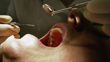 persoana la un control stomatologic medicina dentara
