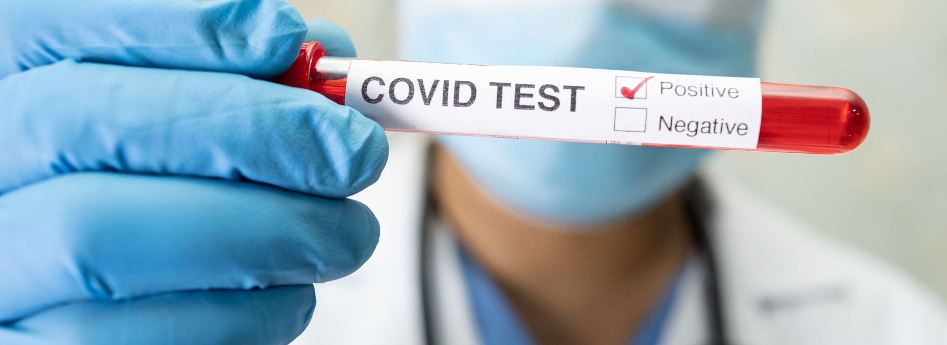 Positive blood infection sample in test tube for covid-19 coronavirus in lab. Scientist holding to check and analyze for patient in hospital.