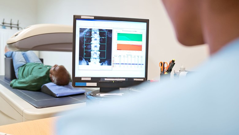 De ce trebuie diagnosticată precoce osteoporoza?