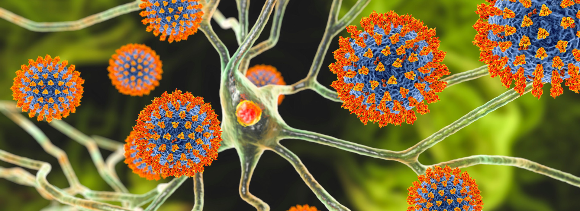 Covid-19 virus infecting nerve cells, illustration