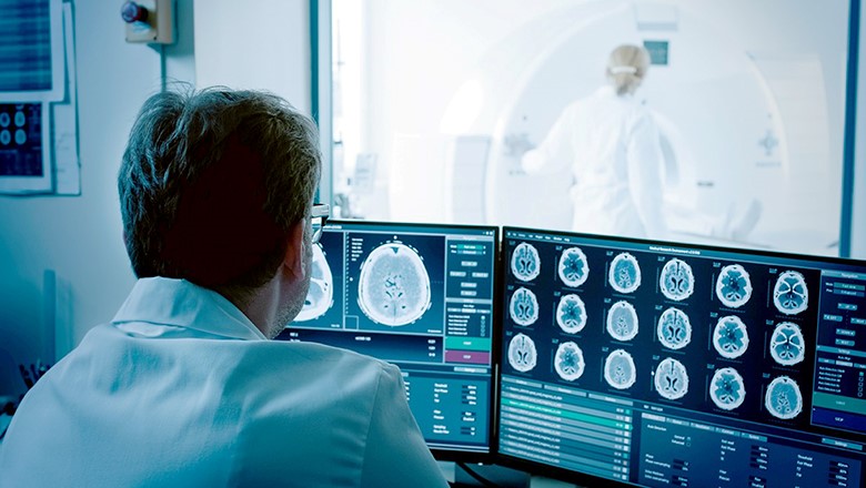 Care sunt semnele accidentului vascular cerebral?