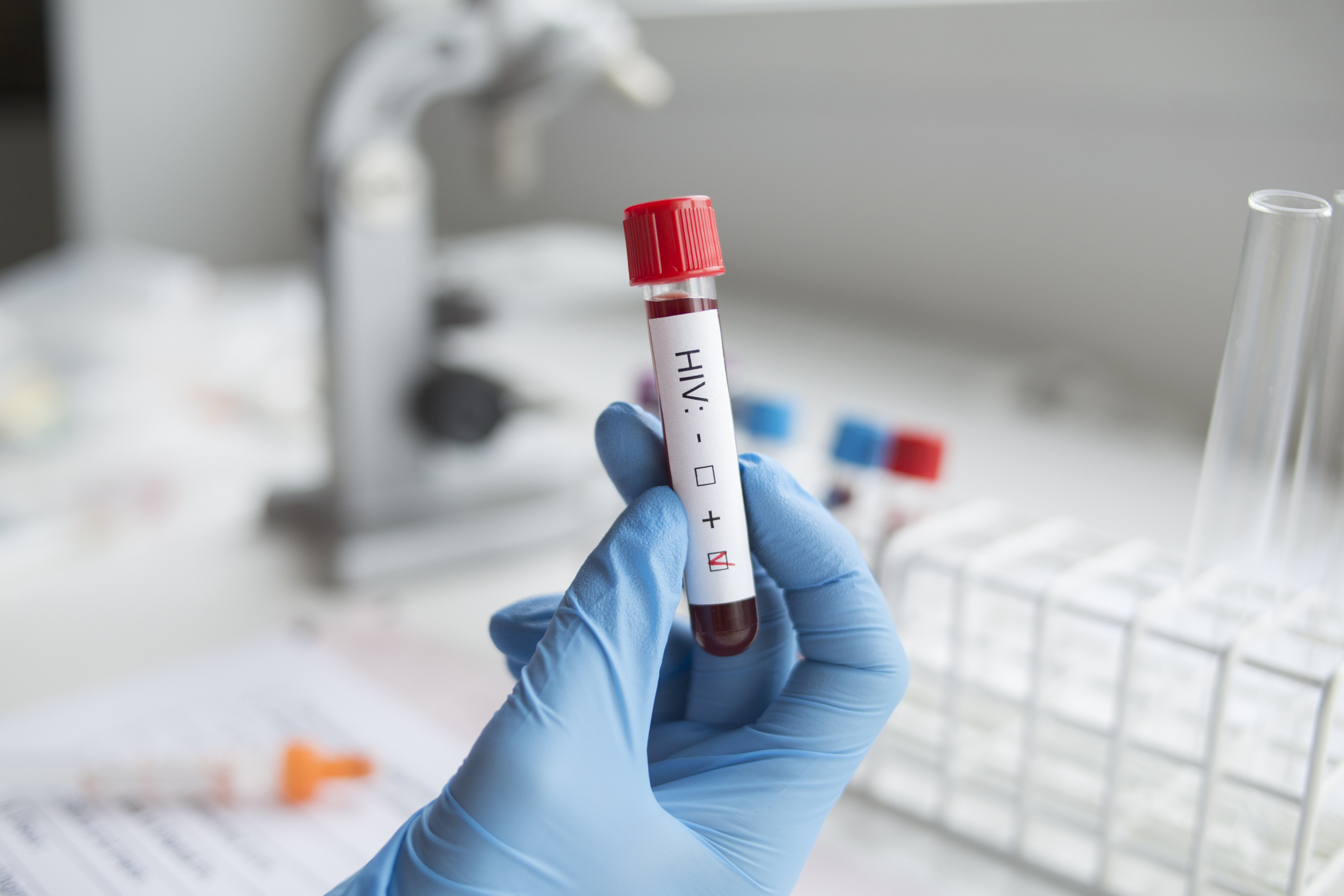 A fost descoperit al doilea pacient care s-a vindecat de HIV fără tratament