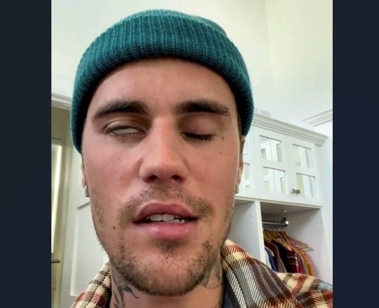 "Furtuna îngrozitoare cu care mă confrunt". Un nou mesaj al lui Bieber, la câteva zile după ce a arătat că nu-și poate mișca fața