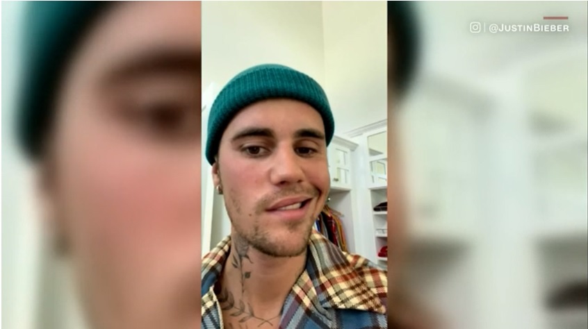 Justin Bieber anunta ca are paralizie faciala din cauza sindromului Ramsay Hunt