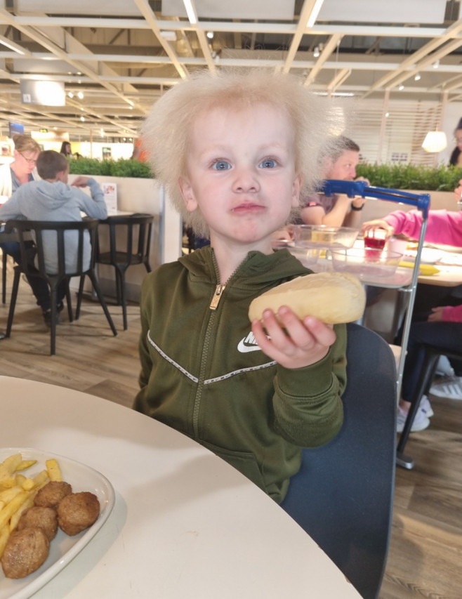 BOY WITH UNCOMBABLE HAIR SYNDROME